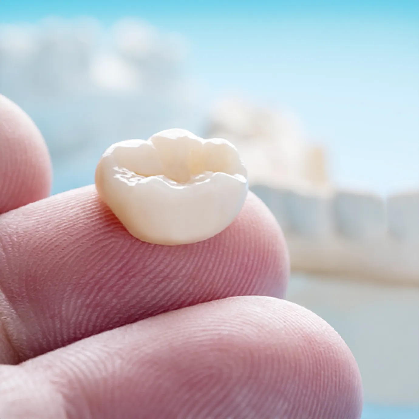 How are broken teeth treated?