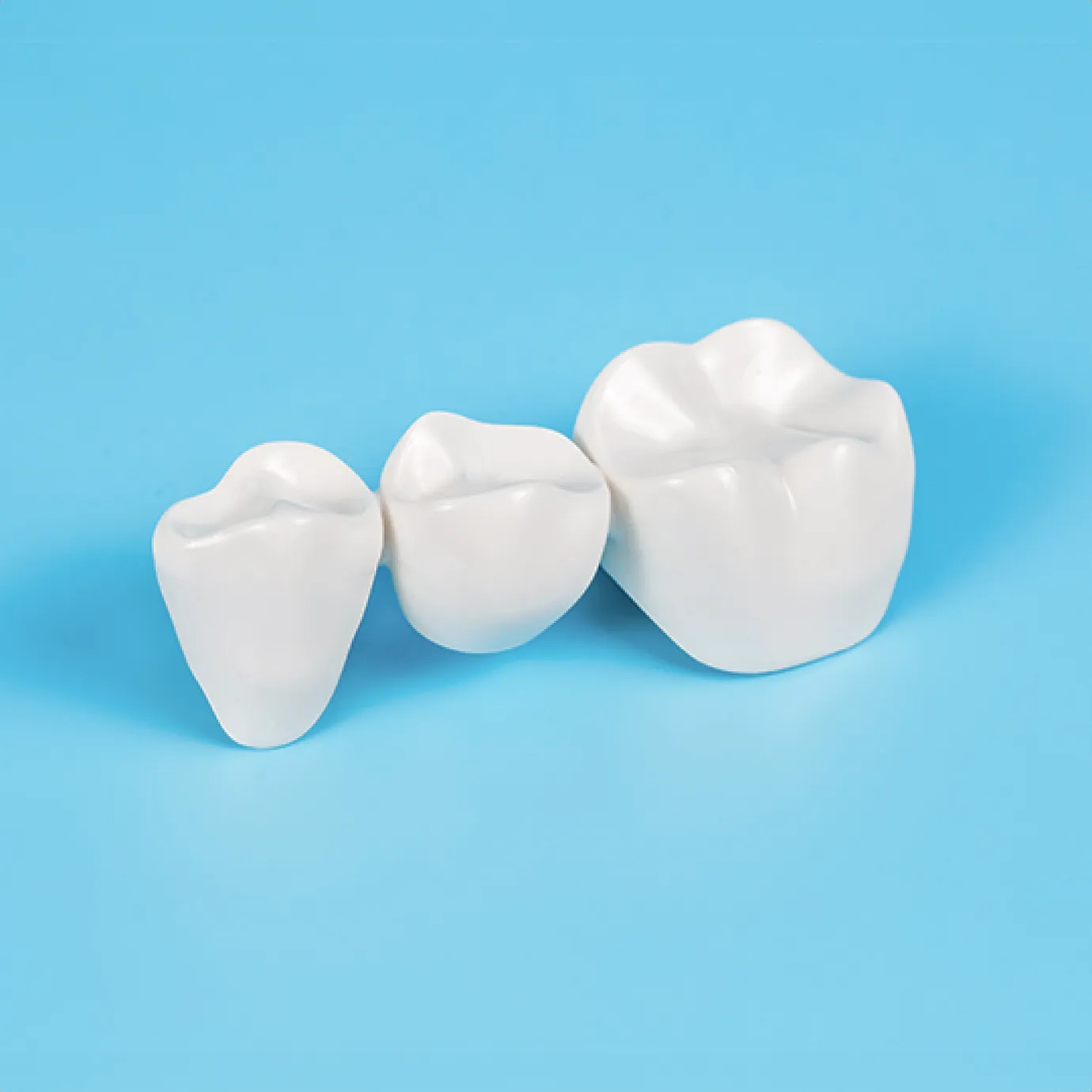 Resin-bonded dental bridge