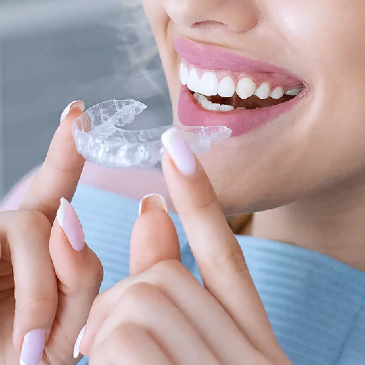 What is Invisalign®? 